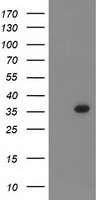 PIH1D2 Antibody