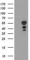 KATNAL1 Antibody