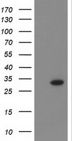 CTDSP1 Antibody