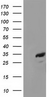 CTDSP1 Antibody