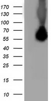 SQSTM1 Antibody