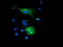 SQSTM1 Antibody