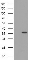 GRHPR Antibody
