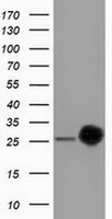 CLPP Antibody
