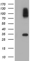 SULT1A1 Antibody