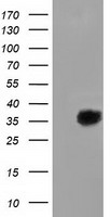 LRATD2 Antibody