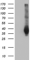 LRATD2 Antibody