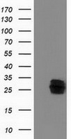 CLPP Antibody