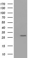 OTUB2 Antibody