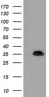 SULT1A1 Antibody