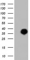 LRATD2 Antibody