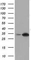 SULT2A1 Antibody