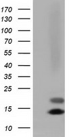 FSH beta Antibody