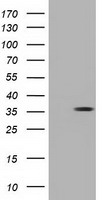 NSMCE2 Antibody