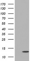 FSH beta Antibody