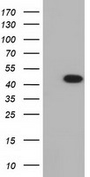 IVD Antibody