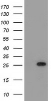 MOBKL2B Antibody