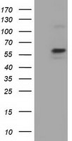 Pyruvate Kinase Antibody
