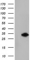ketohexokinase Antibody