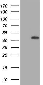 HIBCH Antibody
