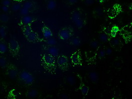 HIBCH Antibody
