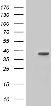HIBCH Antibody
