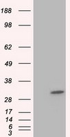 ketohexokinase Antibody