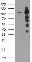 TACC3 Antibody