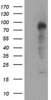 TACC3 Antibody