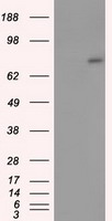 ACSBG1 Antibody