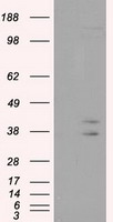 CAPZA1 Antibody