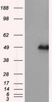 DAP Kinase 2 Antibody