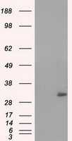 NIT2 Antibody