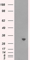 TPMT Antibody