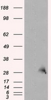 TPMT Antibody