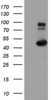 IFT57 Antibody