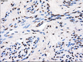 GBE1 Antibody