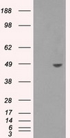 Sorbitol Dehydrogenase Antibody