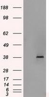 Sorbitol Dehydrogenase Antibody