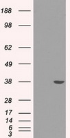 Sorbitol Dehydrogenase Antibody
