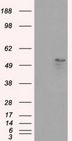 Glucose Transporter 5 GLUT5 Antibody