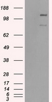 BubR1 Antibody