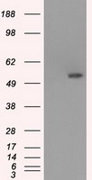 Glucose Transporter 5 GLUT5 Antibody