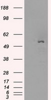 Glucose Transporter 5 GLUT5 Antibody