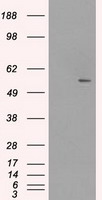 SLC2A5 Antibody