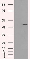 Glucose Transporter 5 GLUT5 Antibody