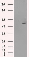 SLC2A5 Antibody