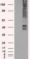 Glucose Transporter 5 GLUT5 Antibody
