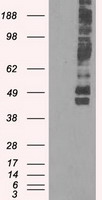 Glucose Transporter 5 GLUT5 Antibody
