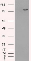 BubR1 Antibody